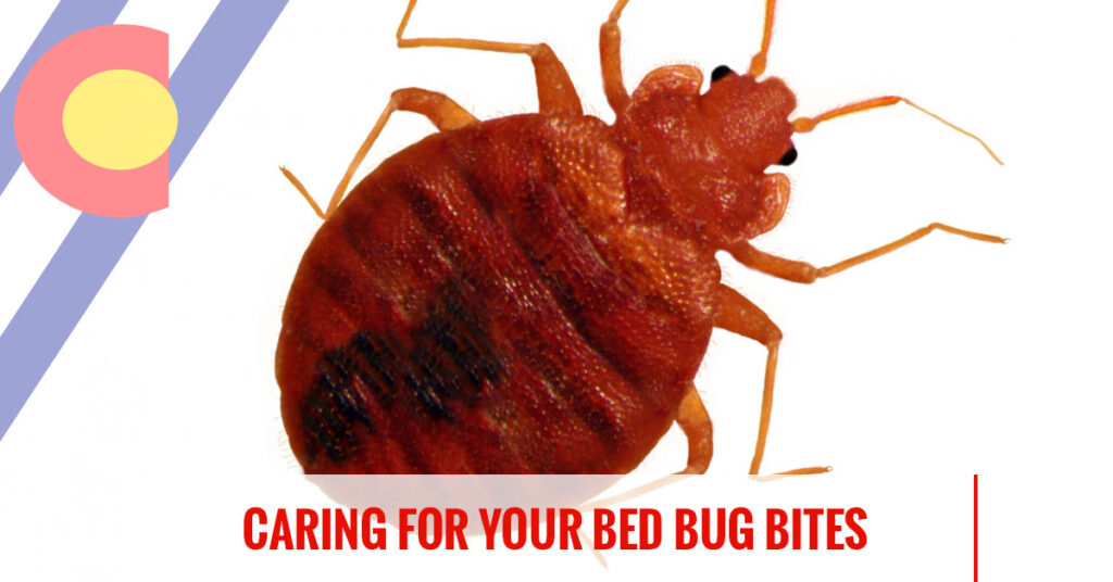 Caring for your bed bug bites