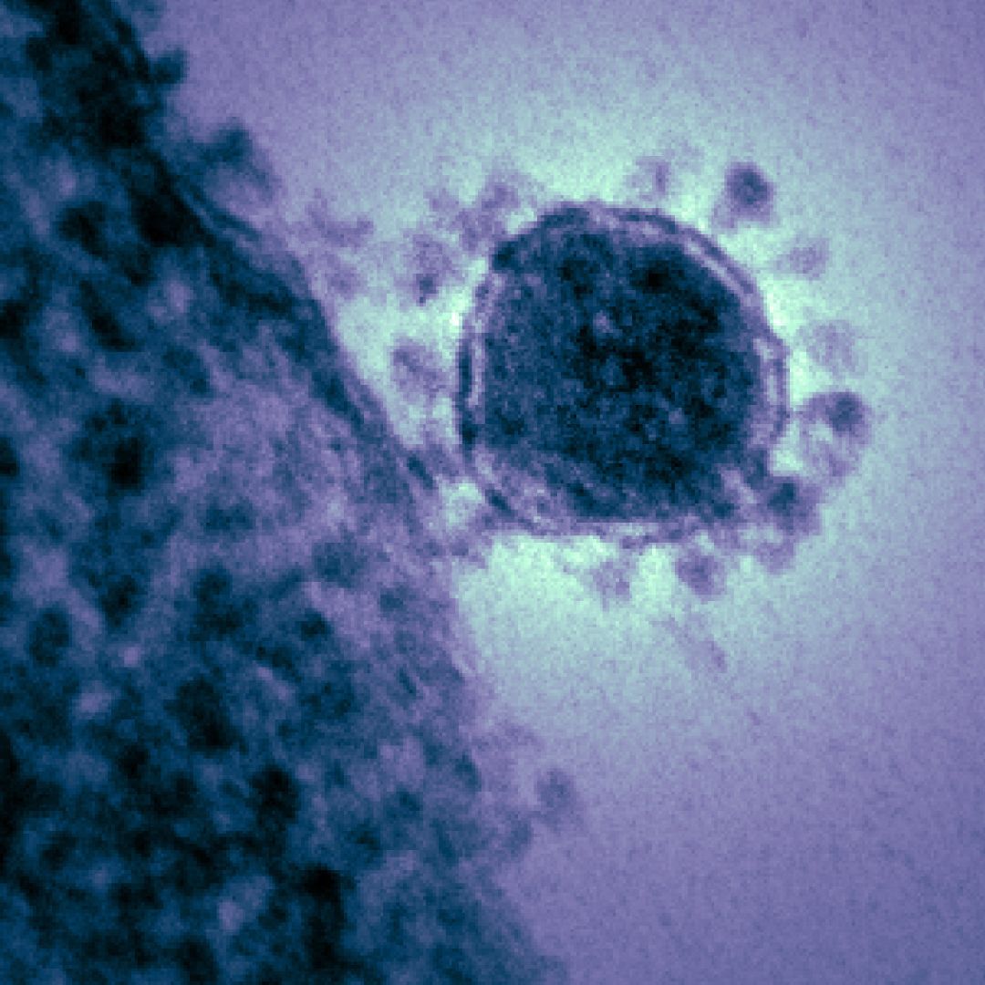 Bacteria or virus under microscope